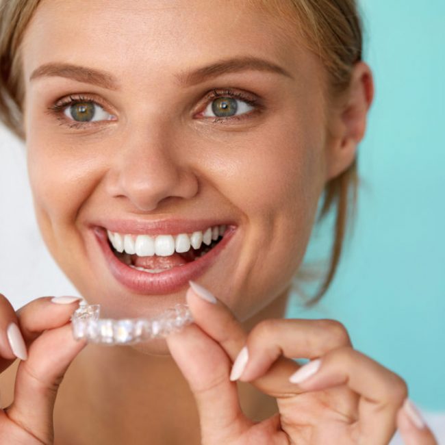 Smiling Woman With Beautiful Smile Using Teeth Whitening Tray. High Resolution Image Teeth Whitening. Beautiful Smiling Woman With White Smile, Straight Teeth Using Teeth Whitening Tray. Girl Holding Invisible Braces, Teeth Trainer. Dental Treatment Concept. High Resolution Image