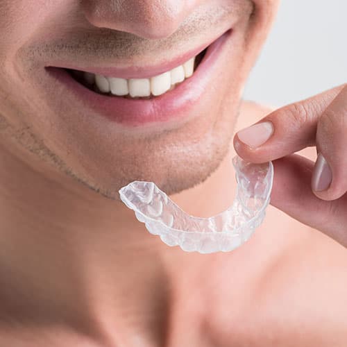 invisalign3 invisalign3